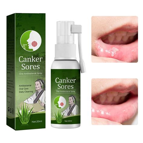 Buy LDREAMAMCleanpure Antiviral Mouth Spray Mouth Ulcer Protect