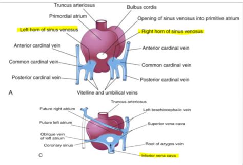 sess 5: changes to sinus venosus, ventricular septation Flashcards ...