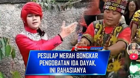 Pesulap Merah Bongkar Trik Pengobatan Ida Dayak Dari Keahlian Pijit