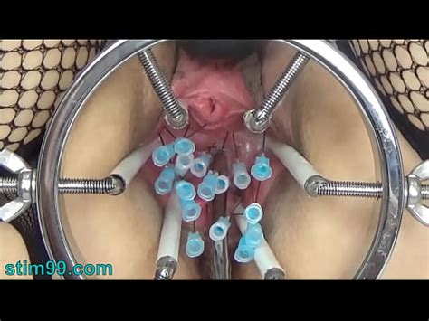 Extreme German BDSM inner Pussy Cervix and Tits XVIDEOSダウンローダー