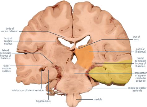 Posterior Cerebral Artery