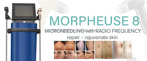 Radiofrequency Technology Microneedling Device Morpheus8 For Acne