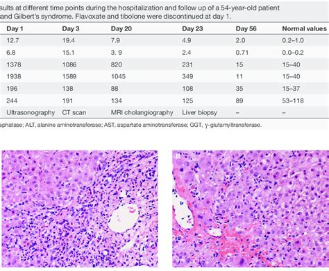 Histologic Image From The Liver Biopsy Of A 54 Year Old Patient With