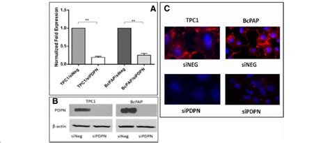 Downregulation Of Podoplanin Expression In Bcpap Thyroid Cancer Cells