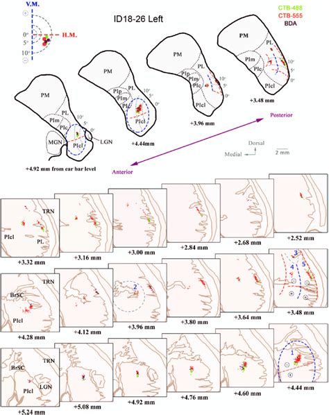 Illustrations Of The Pulvinar And Observed Retrograde Labeling In The