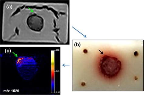 Acquisition Workflow Beginning With Mri A Then Tissue Cryosectioning