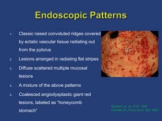 GASTRIC ANTRAL VASCULAR ECTASIA