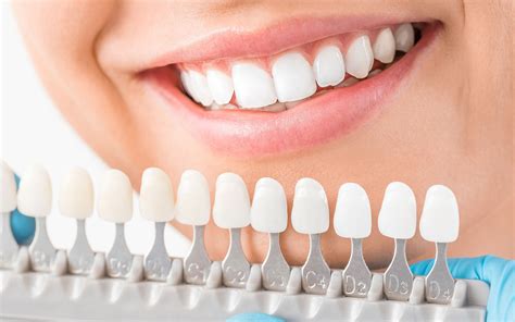 How To Take Care Of Dental Implants Birthrepresentative14