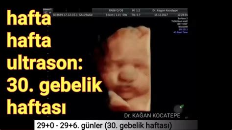 30 gebelik haftasında anne karnındaki bebek açıklamalı ultrason