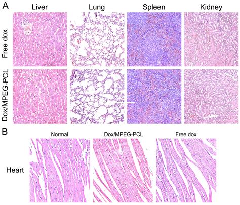 Improved Antitumor Activity And Reduced Myocardial Toxicity Of