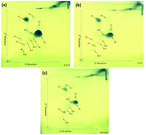 Two Dimensional Thin Layer Chromatograms Of The Polar Lipids From A