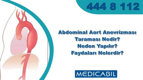 Blog Abdominal Aort Anevrizması Taraması Nedir Neden Yapılır