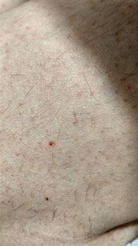 Как обрабатывать эти ранки? Похожи ли эти ранки на укуси кота??? и как ...