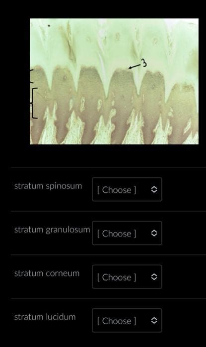 Solved stratum spinosum stratum granulosum stratum corneum | Chegg.com