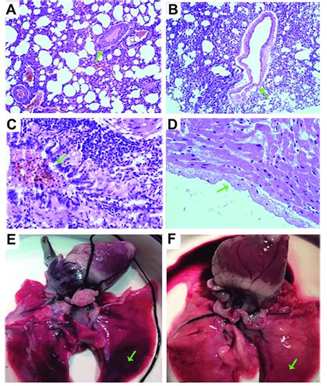 Hande Staining Of Pulmonary Arteries And Photos Of The Lung From Control