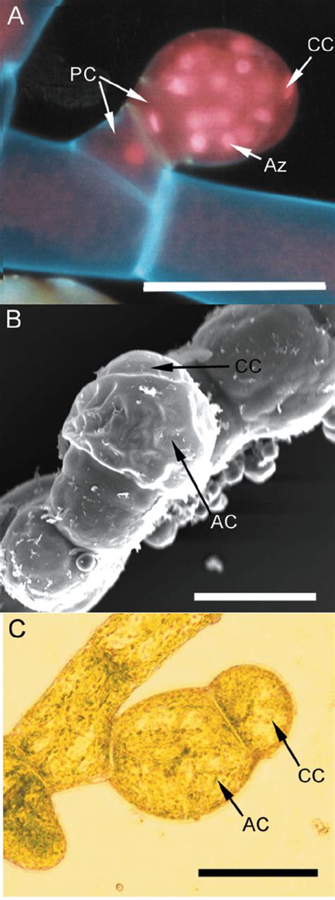 Antheridia Are Male Reproductive Organs That Are Found Throughout The Download Scientific