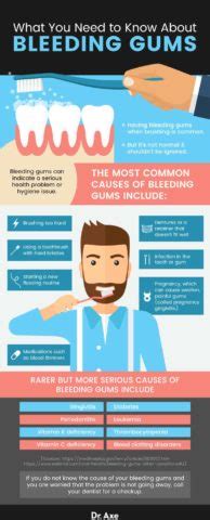 Bleeding Gums (Plus 5 Ways to Improve Gum Health) - Dr. Axe