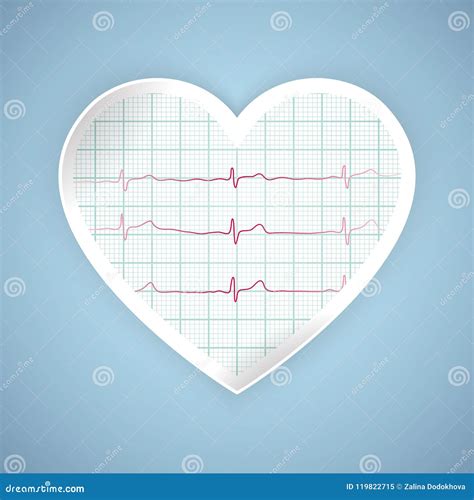 Kierowa Puls Grafika EKG Bicie Serca Na Monitorze Opieka Zdrowotna