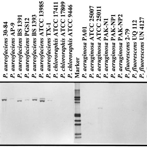 Southern Hybridization Of Phzo Probe To Total Genomic Dna From