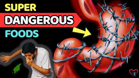 Stay Away The 7 Most Dangerous Foods You Still Eat Everyday Vitality Solutions Youtube