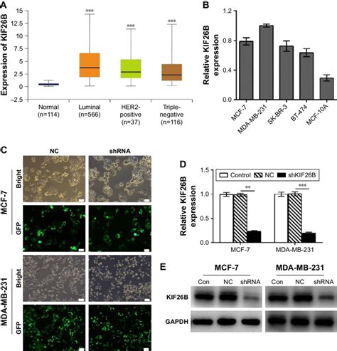 Lentivirus Mediated Gene Knockdown Of KiF26B In Breast Cancer Cells