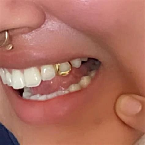 Real 14K Gold Open Face Canine Custom Tooth Cap Custom Grillz Teeth