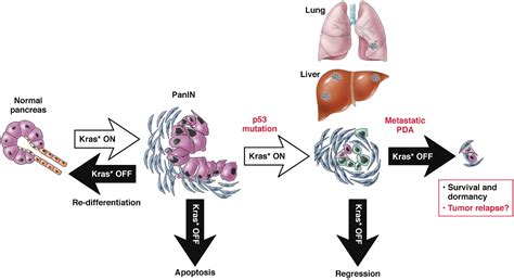 Roles For Kras In Pancreatic Tumor Development And Progression