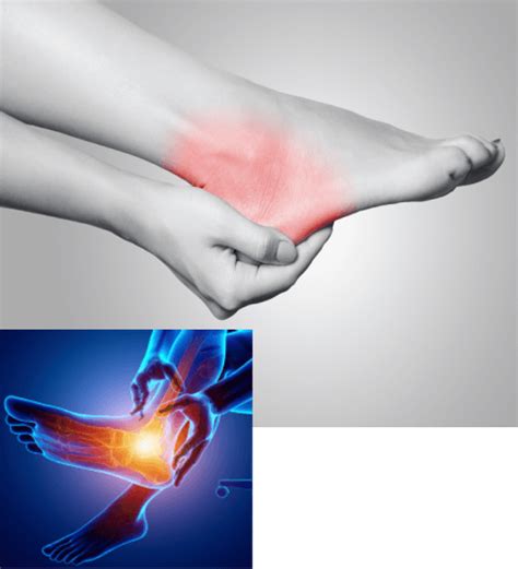 Heel Pain Treatments Twin Hills Health