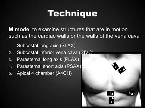 Focused Cardiac Ultrasound Ppt