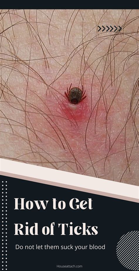 How To Get Rid Of Ticks From Home And Garden