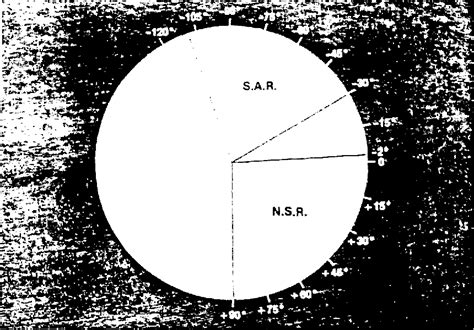 Figure 2 from The P-wave morphology : what does it tell us ? | Semantic ...