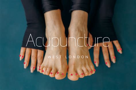 Jing Well Points Acupuncture West London