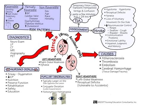 Stroke - CVA - Signs & Symptoms o Headache o Mental Status Changes ...