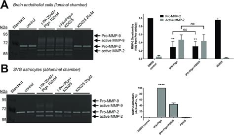 Selective Rock 2 Inhibition Blocks Rt Pa Induced Mmp 2 Activation In Download Scientific