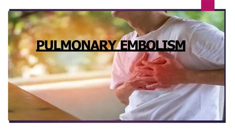 Pulmonary Embolism Pptx