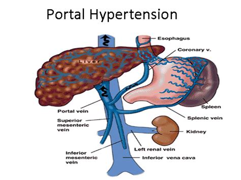 Liver And Portal Hypertension Gastro Surgery Group