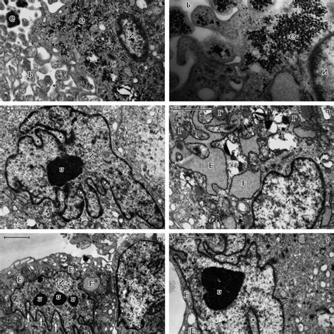 Human Muscle Derived Stem Cells In Transmission Electron Microscope A