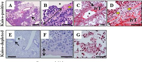 Figure 1 From Loss Of Kaiso Expression In Breast Cancer Cells Prevents