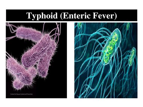 Typhoid Fever Bacteria Shape