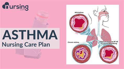 How To Care For A Patient With Asthma Asthma Treatment Nursing Care