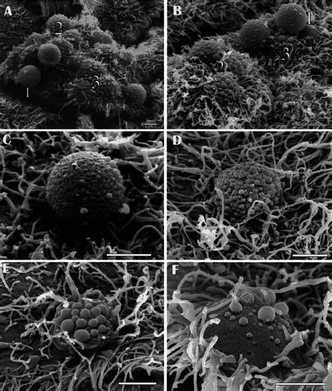 Microscopic Analysis Of S Pyogenes Interactions With Untreated And