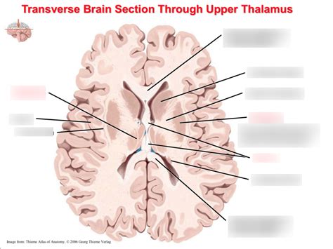 Transverse Brain