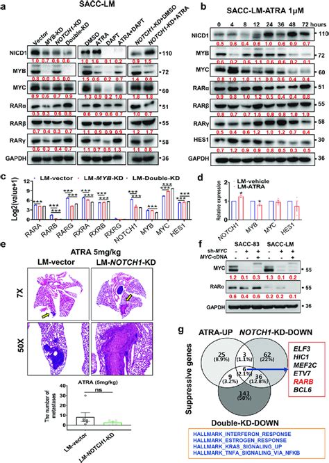 Atra Suppresses The Lung Metastasis Of Sacc In A Mouse Model Possibly