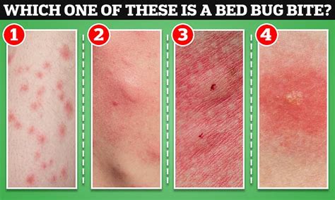 Do You Know Which One Of These Is A Bed Bug Bite Guide On How To Tell If Pip Sized Critter Is