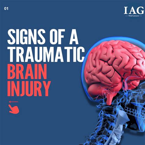 Traumatic Brain Injury Settlements Strategy Updated 2022