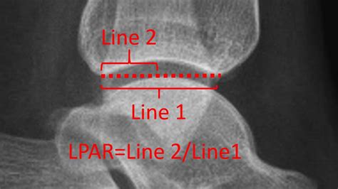 Whats New In Podiatry Journal Article Summary A New Reference To