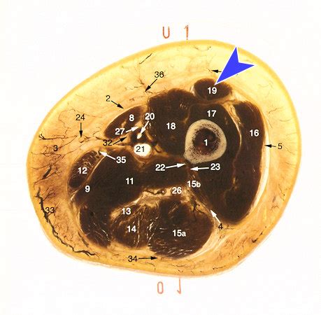 Topographische Anatomie