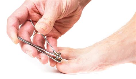 Fixing Ingrown Toenailshome Remedies Or Professional Care