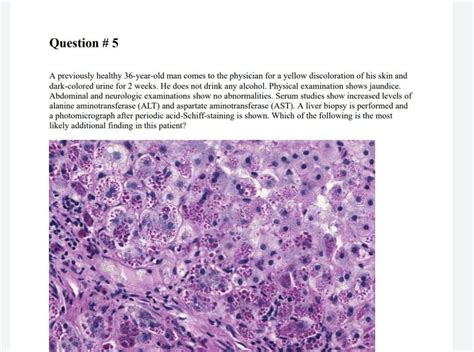 Solved Question 5 A Previously Healthy 36 Year Old Man