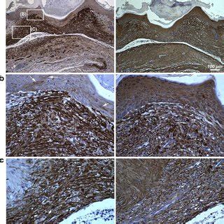 Periostin Is Expressed In Healthy And Pathological Human Skin Samples